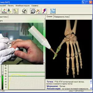 Электропунктурная диагностика по методу Фолля. Аппараты. Курсы  